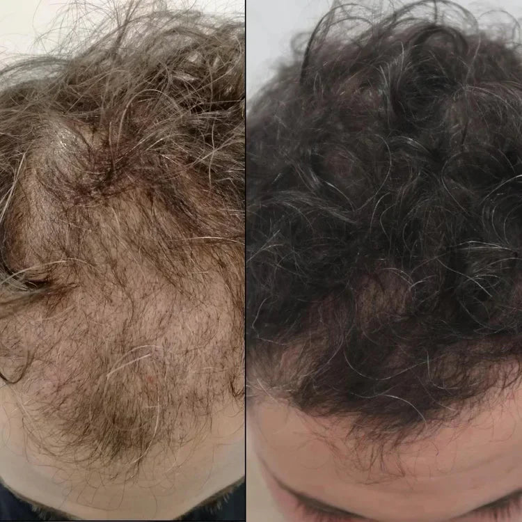 赤色光療法キャップのヘアケアルーティンライフスタイル